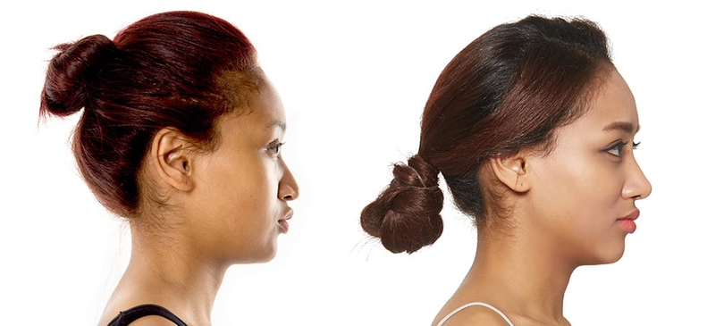 Slider image (4) JK Plastic Surgery 